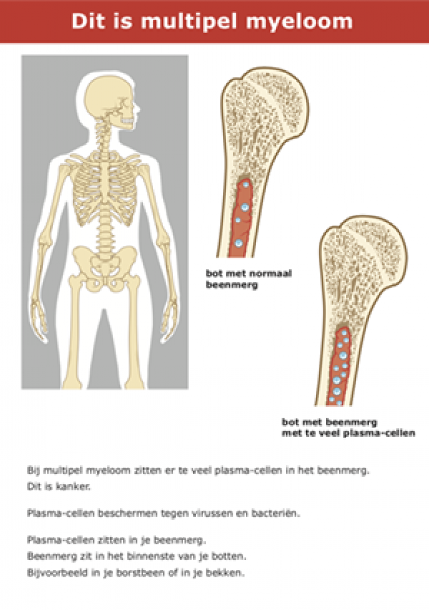 Multipel | Patiëntenorganisatie Hematon