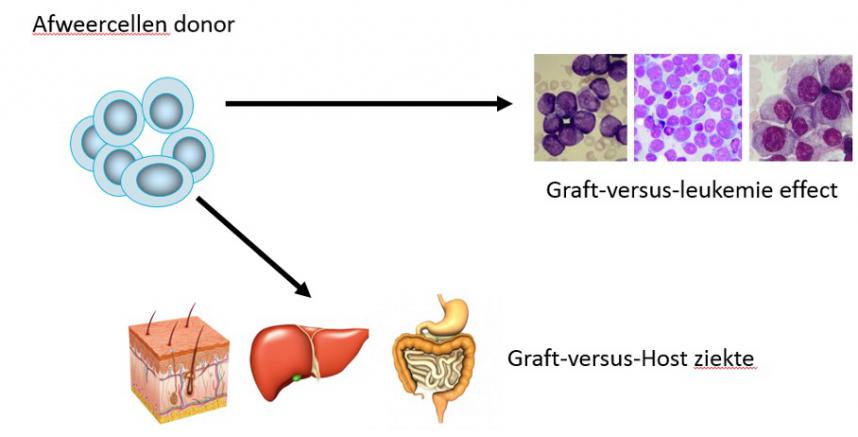 omgekeerde afstoting oftewel graft-versus-host ziekte na stamceltransplantatie met donorcellen